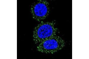 Immunofluorescence (IF) image for anti-V-Akt Murine Thymoma Viral Oncogene Homolog 2 (AKT2) antibody (ABIN5014978) (AKT2 anticorps)