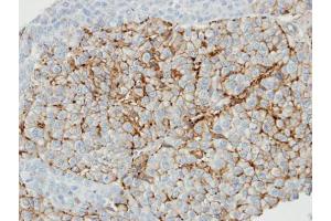IHC-P Image Immunohistochemical microscopy analysis of paraffin-embedded lung carcinoma cell line xenograft tissue using Caveolin-1 antibody [N1N3] , (1:100).