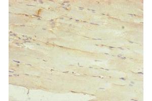 Immunohistochemistry of paraffin-embedded human skeletal muscle tissue using ABIN7142261 at dilution of 1:100 (MRPS22 anticorps  (AA 1-360))