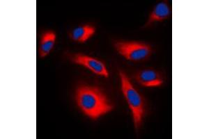 Immunofluorescent analysis of Caspase 6 p18 staining in NIH3T3 cells. (Caspase 6 p18 (Center) anticorps)