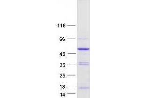 Validation with Western Blot