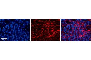 Rabbit Anti-LAPTM4B Antibody     Formalin Fixed Paraffin Embedded Tissue: Human Pineal Tissue  Observed Staining: Membrane and cytoplasmic in processes of pinealocytes and intersticial cells  Primary Antibody Concentration: 1:100  Other Working Concentrations: 1/600  Secondary Antibody: Donkey anti-Rabbit-Cy3  Secondary Antibody Concentration: 1:200  Magnification: 20X  Exposure Time: 0.