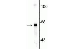 Western blot of rat cortex lysate showing specific immunolabeling of the ~ 66 kDa alpha internexin protein. (INA anticorps)
