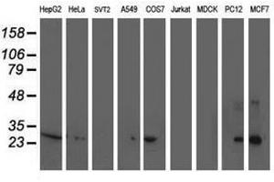 Image no. 1 for anti-Sirtuin 5 (SIRT5) antibody (ABIN1500928)