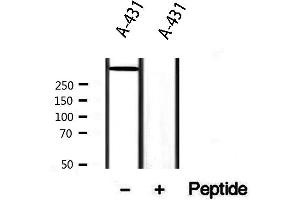 Western blot analysis of extracts from A431, using DST Antibody. (Dystonin anticorps  (C-Term))