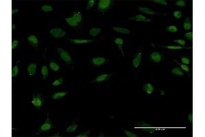 Immunofluorescence of monoclonal antibody to STC1 on HeLa cell.