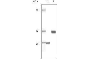 Western Blot showing SRA antibody used against truncated SRA recombinant protein (1) and human ovary cancer tissue lysate (2).