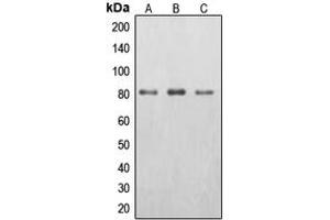Western blot analysis of EPS8L2 expression in HepG2 (A), HeLa (B), A431 (C) whole cell lysates.