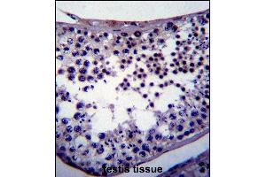 NANOG Antibody (ABIN387791 and ABIN2838027) immunohistochemistry analysis in formalin fixed and paraffin embedded human testis tissue followed by peroxidase conjμgation of the secondary antibody and DAB staining.