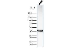 Western Blot Analysis of Human A431 cell lysate using GLUT-1 Mouse Monoclonal Antibody (GLUT1/2476).