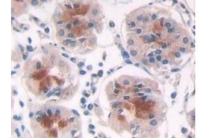 Detection of PSMD2 in Human Stomach Tissue using Polyclonal Antibody to Proteasome 26S Subunit, Non ATPase 2 (PSMD2)