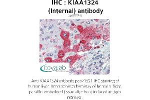 Image no. 2 for anti-Endosome/Lysosome-associated Apoptosis and Autophagy Regulator 1 (ELAPOR1) (Internal Region) antibody (ABIN1736215) (ELAPOR1 anticorps  (Internal Region))