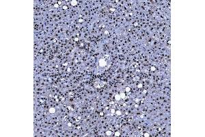 IHC analysis of SF3A1 using anti-SF3A1 antibody (ABIN7600556). (SF3A1 anticorps  (AA 20-556))