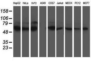 Image no. 4 for anti-X-Prolyl Aminopeptidase (Aminopeptidase P) 3, Putative (XPNPEP3) antibody (ABIN1501766)