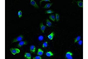 Immunofluorescent analysis of A549 cells using ABIN7173167 at dilution of 1:100 and Alexa Fluor 488-congugated AffiniPure Goat Anti-Rabbit IgG(H+L) (TMEM243 anticorps  (AA 1-31))