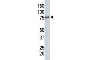 Anti-HA tag antibody testing a tagged recombinant protein. (HA-Tag anticorps)