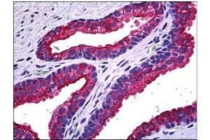 Immunohistochemistry (IHC) image for anti-Natriuretic Peptide Receptor B/guanylate Cyclase B (Atrionatriuretic Peptide Receptor B) (NPR2) antibody (ABIN781925)