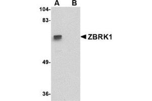 Western blot analysis of ZBRK1 in A-20 lysate with this product at 1 μg/ml in (A) the absence and (B) the presence of blocking peptide. (ZNF350 anticorps  (C-Term))