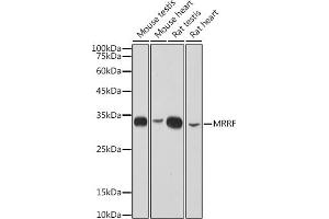 Western blot analysis of extracts of various cell lines, using MRRF antibody (ABIN7268589) at 1:1000 dilution. (MRRF anticorps)