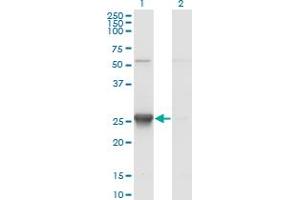 Western Blot analysis of TK1 expression in transfected 293T cell line by TK1 monoclonal antibody (M12), clone 3A8. (TK1 anticorps  (AA 1-234))