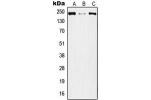 Western blot analysis of Plexin A2 expression in A549 (A), Raw264. (Plexin A2 anticorps  (Center))