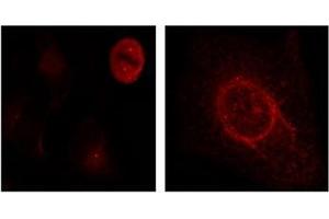 Image no. 3 for anti-Mitogen-Activated Protein Kinase 1/3 (MAPK1/3) (pThr187), (pTyr204) antibody (ABIN197000)