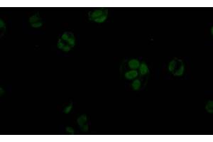 Immunofluorescence staining of MCF7 Cells with ABIN7127801 at 1:50, counter-stained with DAPI. (Recombinant STAG2 anticorps)