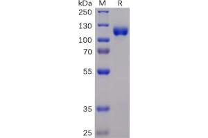 Human EPHA3 Protein, mFc-His Tag on SDS-PAGE under reducing condition. (EPH Receptor A3 Protein (EPHA3) (mFc-His Tag))