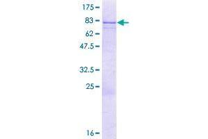 Image no. 1 for BTB (POZ) Domain Containing 3 (BTBD3) (AA 1-522) protein (GST tag) (ABIN1346930)