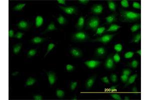 Immunofluorescence of monoclonal antibody to THRAP5 on HeLa cell.