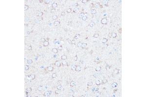 Immunohistochemistry of paraffin-embedded mouse brain using TSC2 Rabbit pAb (ABIN1683176, ABIN5663676 and ABIN7101314) at dilution of 1:100 (40x lens). (Tuberin anticorps)