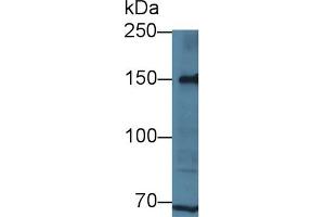 Detection of LRP8 in Human Hela cell lysate using Polyclonal Antibody to Low Density Lipoprotein Receptor Related Protein 8 (LRP8) (LRP8 anticorps  (AA 696-941))