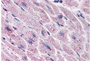 Immunohistochemistry (Formalin/PFA-fixed paraffin-embedded sections) of human heart tissue with EDNRA polyclonal antibody . (Endothelin-1 Receptor anticorps  (C-Term))