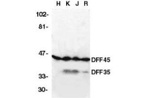 Western blot analysis of DFF45 in HeLa (H), K562 (K) Jurkat (J), and Raji (R) cell lysates with DFF45 antibody at 2μg/ml.