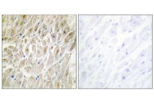 Immunohistochemistry analysis of paraffin-embedded human heart tissue using DLX3 antibody. (DLX3 anticorps  (Internal Region))