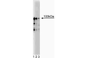 Western blot analysis of UBE3A on a EB-1 cell lysate (Human B lymphoblast, Burkitt's lymphoma, ATCC HTB-60).