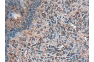 Detection of HMWK in Rat Ovary Tissue using Polyclonal Antibody to High Molecular Weight Kininogen (HMWK)