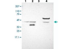 Western blot analysis of Lane 1: RT-4, Lane 2: EFO-21, Lane 3: U-138 MG, Lane 4: Liver, Lane 5: Tonsil with ACOT4 polyclonal antibody . (ACOT4 anticorps)