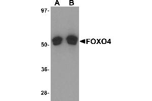 Western Blotting (WB) image for anti-Forkhead Box O4 (FOXO4) (N-Term) antibody (ABIN1031692) (FOXO4 anticorps  (N-Term))