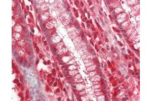 Human Colon: Formalin-Fixed, Paraffin-Embedded (FFPE).