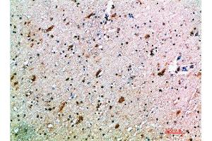 Immunohistochemical analysis of paraffin-embedded human-brain, antibody was diluted at 1:200 (KLRK1 anticorps  (AA 167-216))