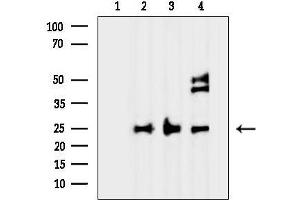anti-Prokineticin 1 (Prok1) antibody
