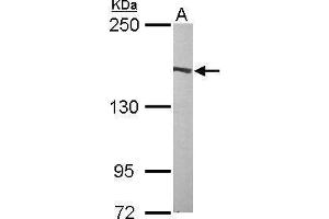 WB Image Sample (50 ug of whole cell lysate) A: Mouse brain 5% SDS PAGE antibody diluted at 1:1000 (Flightless I anticorps  (Internal Region))