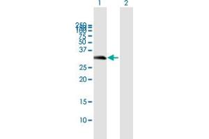 Western Blot analysis of C16orf57 expression in transfected 293T cell line by C16orf57 MaxPab polyclonal antibody. (C16orf57 anticorps  (AA 1-265))