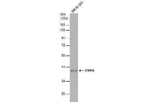 WB Image Whole cell extract (30 μg) was separated by 10% SDS-PAGE, and the membrane was blotted with GNAQ antibody , diluted at 1:500. (GNAQ anticorps  (Center))
