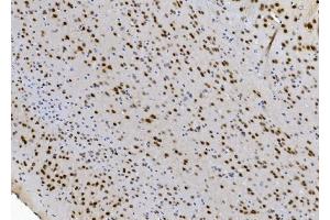 IHC analysis of NOVA2 using anti-NOVA2 antibody (ABIN7599078). (NOVA2 anticorps  (AA 1-205))