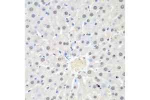 Immunohistochemistry of paraffin-embedded rat liver using WDR48 antibody at dilution of 1:100 (40x lens). (WDR48 anticorps)