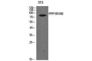 Western Blotting (WB) image for anti-Protein Phosphatase 1, Regulatory Subunit 15B (PPP1R15B) (Internal Region) antibody (ABIN3181424) (PPP1R15B anticorps  (Internal Region))