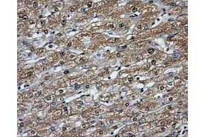 Immunohistochemical staining of paraffin-embedded liver tissue using anti-BTK mouse monoclonal antibody. (BTK anticorps)
