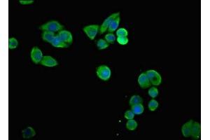 Immunofluorescent analysis of PC-3 cells using ABIN7169948 at dilution of 1:100 and Alexa Fluor 488-congugated AffiniPure Goat Anti-Rabbit IgG(H+L)